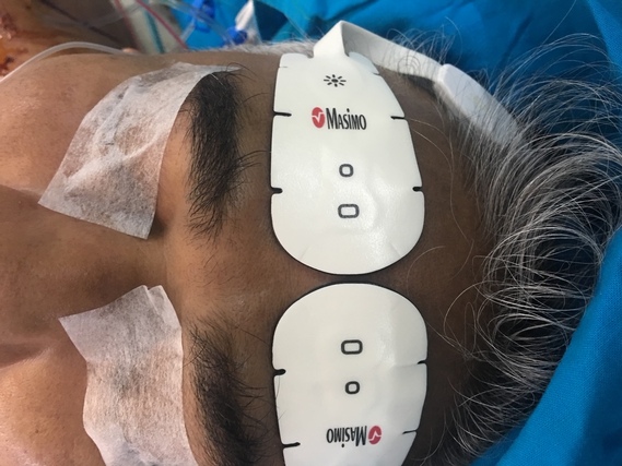 Anaesthesiology Unit 1