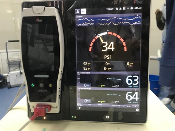 Anaesthesiology Unit 2